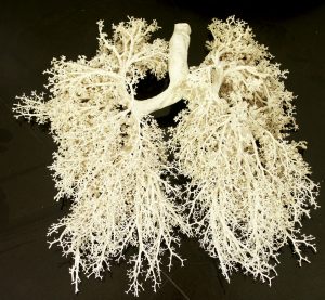 Cardiopulmonary rehab NPTE